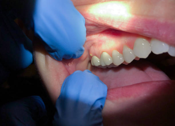 Best Mobile Emergency Dentist in Culloden, WV