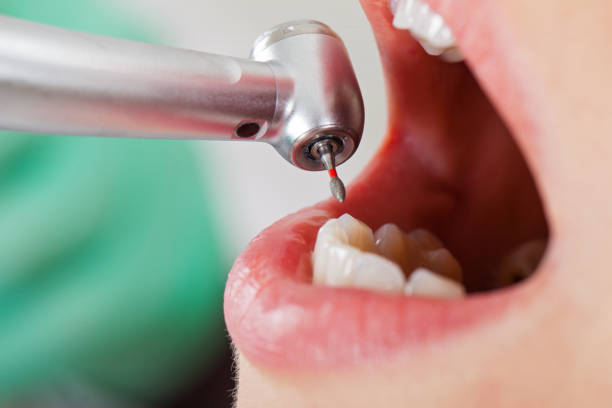 Best Orthodontic Emergency Dentist in Culloden, WV